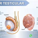 testicular